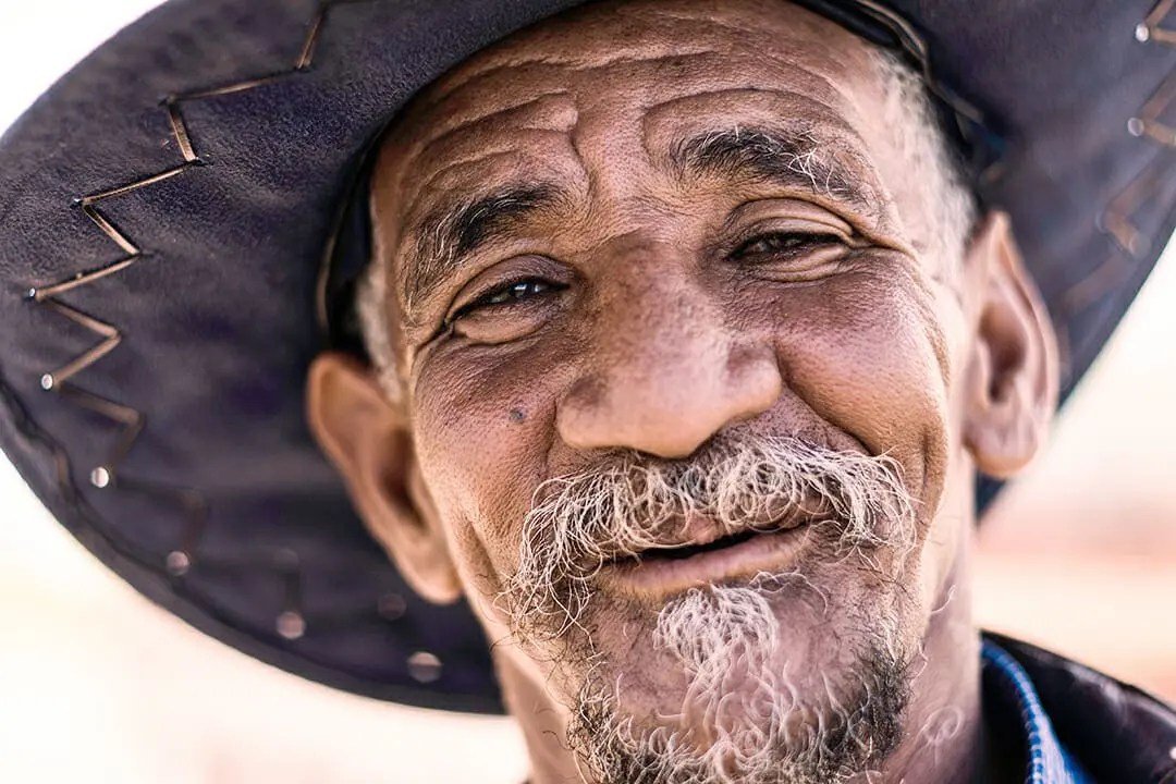 How Old Is Albedo In Fire Force Character Not Listed